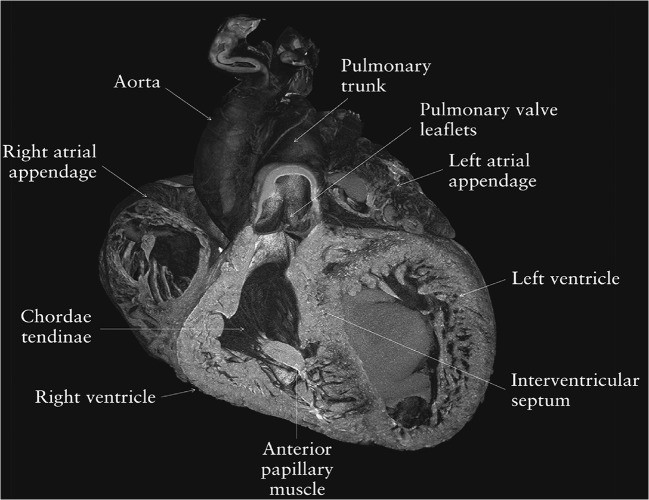 Novel imaging techniques to study postmortem human fetal anatomy: a systematic review on microfocus-CT and ultra-high-field MRI